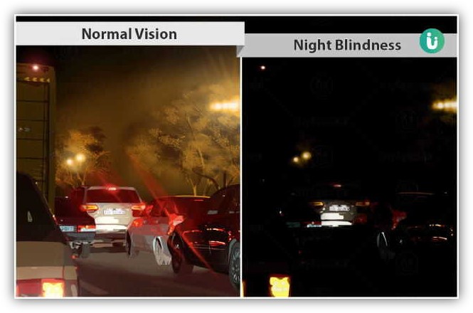 night blindness versus normal vision